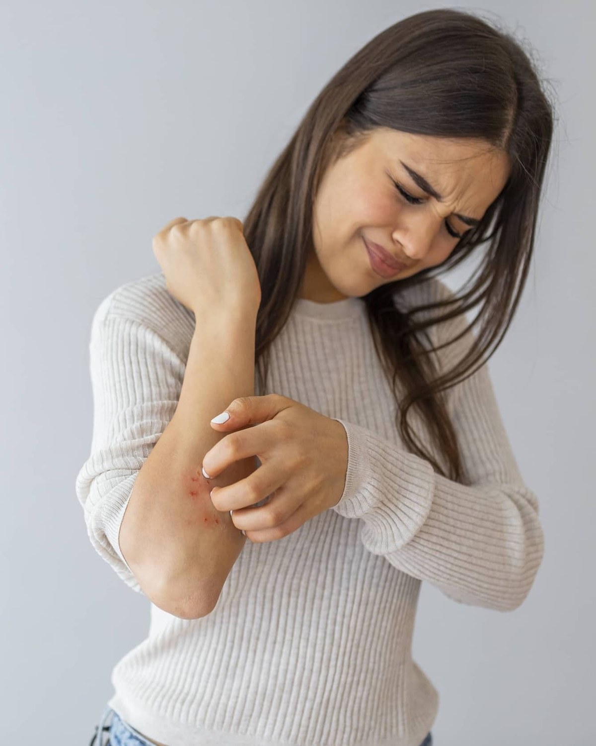 A woman holding her forearm, where the skin is red and irritated