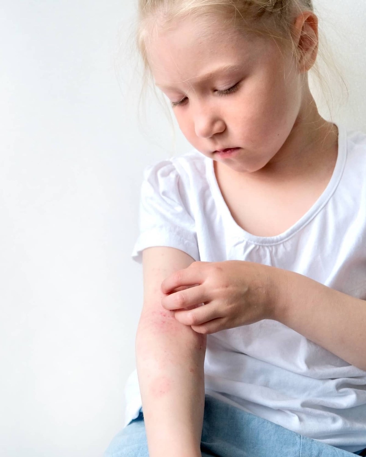 A young child scratching irritated skin on her arm